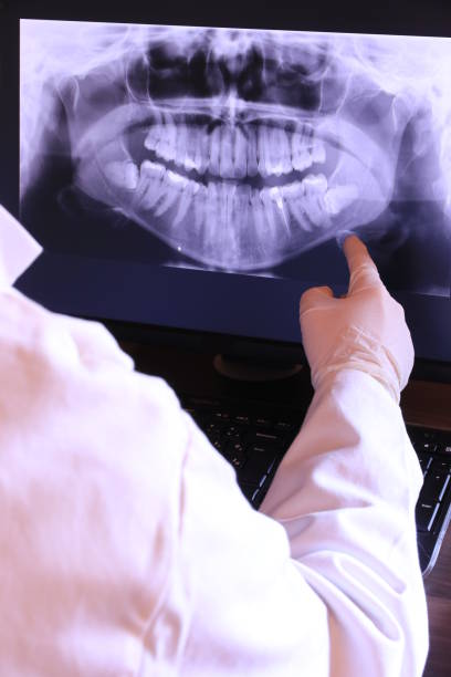 Best Emergency Dental Care for Abscessed Tooth in Wolfe City, TX