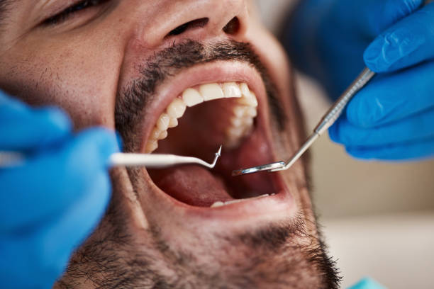 Best Holiday Emergency Dentist in Wolfe City, TX
